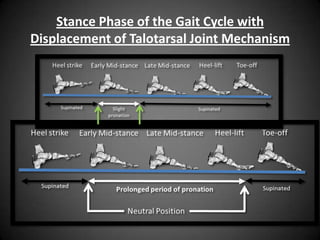 What is the role of an arch
         support?
 