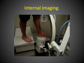 Is this arch support working?
 