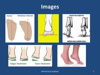 Images
ORTHOTICS SCIENCE 3
 