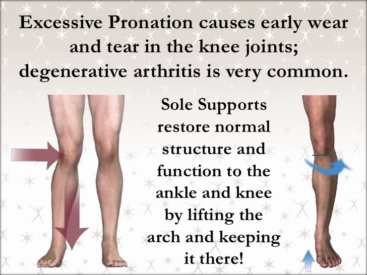 Stop Suffering From Foot, Knee, Hip, and Back Pain!
