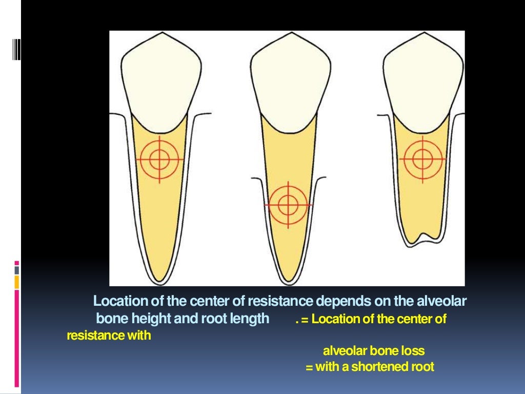 Orthodontic tooth movement ppt.