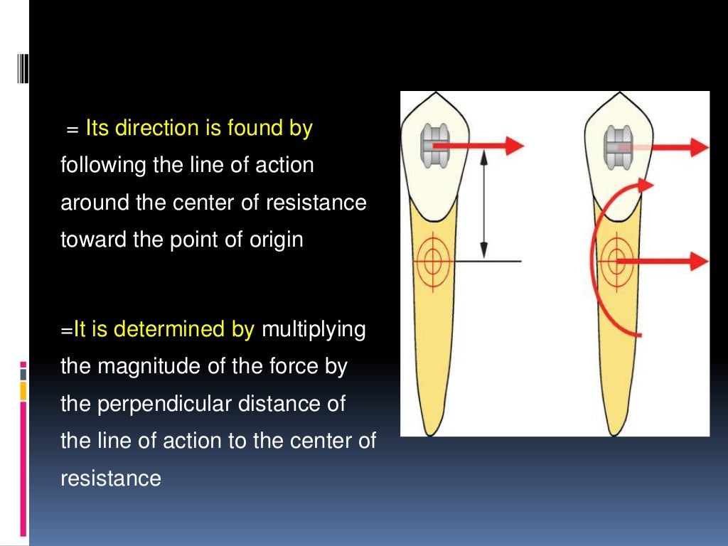 Orthodontic tooth movement ppt.