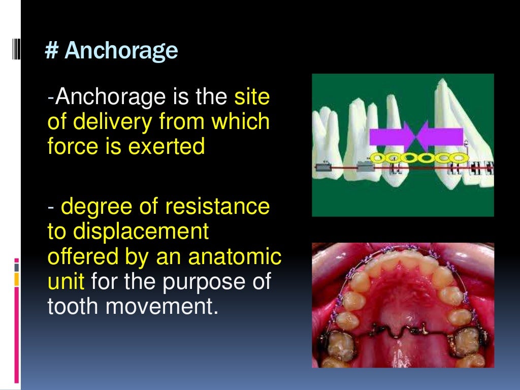 Orthodontic tooth movement ppt.