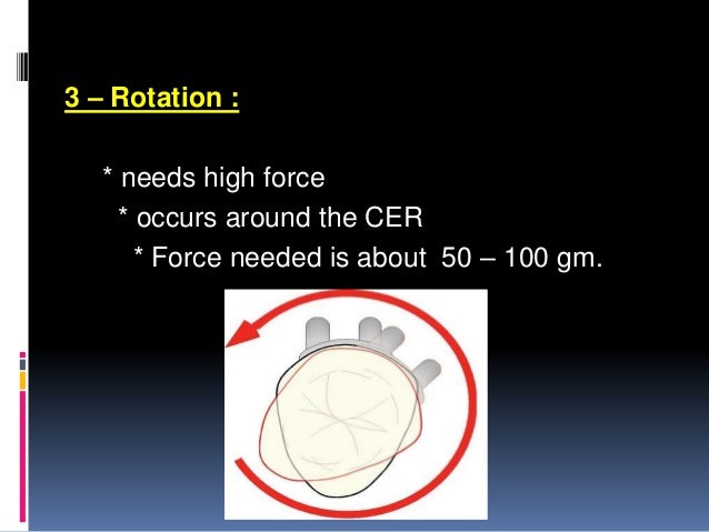 Orthodontic tooth movement ppt. simple engine piston diagram 