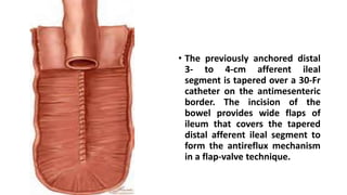 • The previously anchored distal
3- to 4-cm afferent ileal
segment is tapered over a 30-Fr
catheter on the antimesenteric
border. The incision of the
bowel provides wide flaps of
ileum that covers the tapered
distal afferent ileal segment to
form the antireflux mechanism
in a flap-valve technique.
 