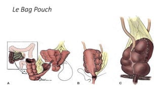 Le Bag Pouch
 