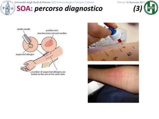 Università degli Studi di Firenze SOD Immunologia e Terapie Cellulari             	           Firenze 15 Gennaio 2011SOA: percorso diagnostico                 (3)