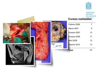 Cursos realizados
Febrero 2006    7

Marzo 2007      9

Octubre 2007   13

Octubre 2008   17

Abril 2009     12

Febrero 2010   13

Total          71
 