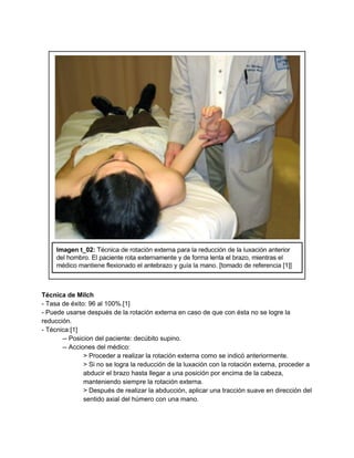  
 
 
Técnica de Milch 
­ Tasa de éxito: 96 al 100%.[1] 
­ Puede usarse después de la rotación externa en caso de que con ésta no se logre la 
reducción. 
­ Técnica:[1] 
­­ Posicion del paciente: decúbito supino. 
­­ Acciones del médico: 
> Proceder a realizar la rotación externa como se indicó anteriormente. 
> Si no se logra la reducción de la luxación con la rotación externa, proceder a 
abducir el brazo hasta llegar a una posición por encima de la cabeza, 
manteniendo siempre la rotación externa. 
> Después de realizar la abducción, aplicar una tracción suave en dirección del 
sentido axial del húmero con una mano. 
 