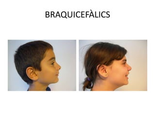 BRAQUICEFÀLICS