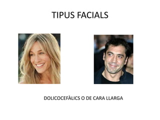 TIPUS FACIALSDOLICOCEFÀLICS O DE CARA LLARGA