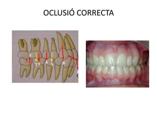 OCLUSIÓ CORRECTA