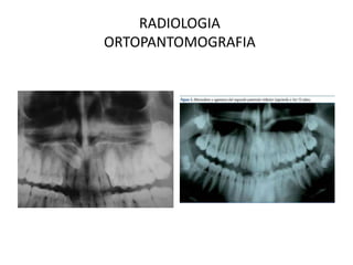 RADIOLOGIAORTOPANTOMOGRAFIA