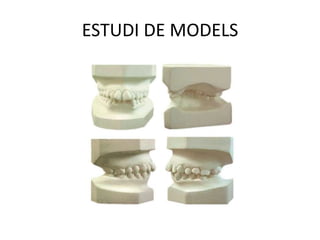 ESTUDI DE MODELS
