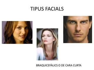 TIPUS FACIALSBRAQUICEFÀLICS O DE CARA CURTA
