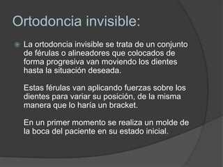 Ortodoncia invisible:<br />La ortodoncia invisible se trata de un conjunto de férulas o alineadores que colocados de forma...