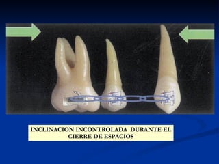 Ortodoncia | PPT