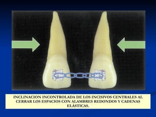 Ortodoncia | PPT