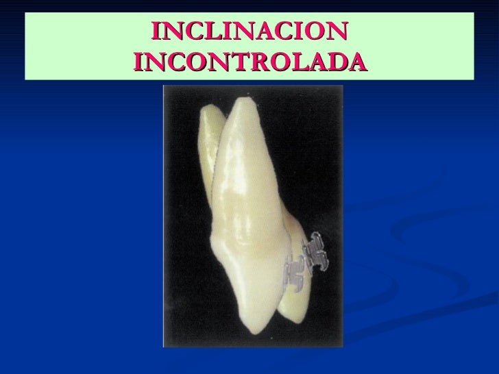 Ortodoncia