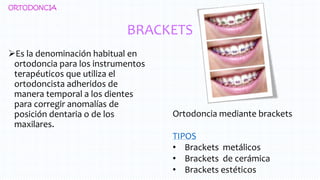 BRACKETS
Es la denominación habitual en
ortodoncia para los instrumentos
terapéuticos que utiliza el
ortodoncista adheridos de
manera temporal a los dientes
para corregir anomalías de
posición dentaria o de los
maxilares.
ORTODONCIA
Ortodoncia mediante brackets
TIPOS
• Brackets metálicos
• Brackets de cerámica
• Brackets estéticos
 