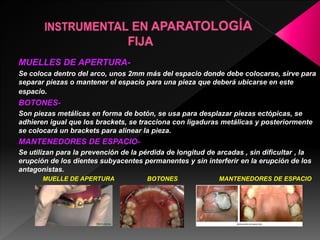 MUELLES DE APERTURA-Se 
coloca dentro del arco, unos 2mm más del espacio donde debe colocarse, sirve para 
separar piezas o mantener el espacio para una pieza que deberá ubicarse en este 
espacio. 
BOTONES-Son 
piezas metálicas en forma de botón, se usa para desplazar piezas ectópicas, se 
adhieren igual que los brackets, se tracciona con ligaduras metálicas y posteriormente 
se colocará un brackets para alinear la pieza. 
MANTENEDORES DE ESPACIO-Se 
utilizan para la prevención de la pérdida de longitud de arcadas , sin dificultar , la 
erupción de los dientes subyacentes permanentes y sin interferir en la erupción de los 
antagonistas. 
MUELLE DE APERTURA BOTONES MANTENEDORES DE ESPACIO 
 