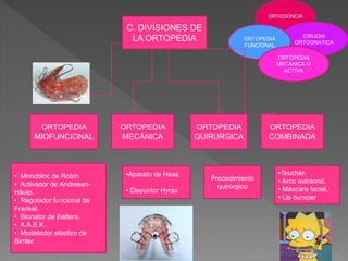 ORTOPEDIA 
MIOFUNCIONAL 
ORTOPEDIA 
QUIRÚRGICA 
ORTOPEDIA 
MECÁNICA 
ORTODONCIA 
CIRUGIA 
ORTOGNATICA 
ORTOPEDIA 
COMBINADA 
C. DIVISIONES DE 
LA ORTOPEDIA 
• Monobloc de Robín 
• Activador de Andresen- 
Häulp. 
• Regulador funcional de 
Frankel. 
• Bionator de Balters. 
• A.A.E.K. 
• Modelador elástico de 
Bimler. 
•Aparato de Haas 
• Disyuntor Hyrax 
Procedimiento 
quirúrgico 
•Teucher. 
• Arco extraoral. 
• Máscara facial. 
• Lip bumper 
ORTOPEDIA 
FUNCIONAL 
ORTOPEDIA 
MECÁNICA O 
ACTIVA 
 