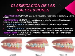 • NEUTOCLUSIÓN (CLASE 1). Existe una relación normal entre el maxilar superior e 
inferior. 
• DISTOCLUSIÓN (CLASE 2). La mandíbula se encuentra en posición distal con 
respecto el maxilar superior (hacia atrás). 
1. CLASE 2 DIVISIÓN 1. Se caracteriza por estar los incisivos superiores en 
protrusión 
2. CLASE 2 DIVISIÓN 2. .Los incisivos centrales superiores están retro inclinados, 
y los incisivos laterales se encuentran con una marcada inclinación vestibular. 
MESIOCLUSIÓN (CLASE 3). La mandíbula se encuentra en posición anterior con 
respecto el maxilar superior. 
 