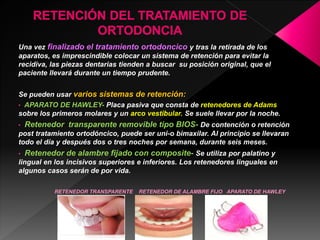 Ortodoncia
