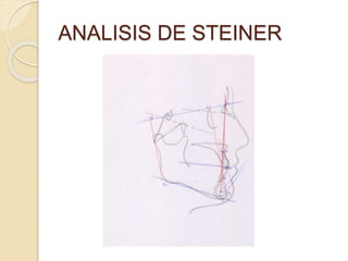 ANALISIS DE STEINER
 