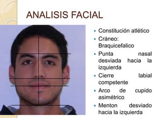 ANALISIS FACIAL
 Constitución atlético
 Cráneo:
Braquicefalico
 Punta nasal
desviada hacia la
izquierda
 Cierre labial
competente
 Arco de cupido
asimétrico
 Menton desviado
hacia la izquierda
 