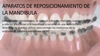 APARATOS DE REPOSICIONAMIENTO DE
LA MANDIBULA
Denominados entablillados, se colocan sobre los maxilares superior
e inferior y entrenan a la mandíbula a cerrarse en una posición más
favorable. Se pueden utilizar para corregir los trastornos de la
articulación temporo mandibular (ATM).
 