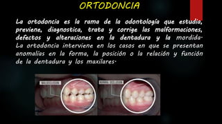 ORTODONCIA
La ortodoncia es la rama de la odontología que estudia,
previene, diagnostica, trata y corrige las malformaciones,
defectos y alteraciones en la dentadura y la mordida.
La ortodoncia interviene en los casos en que se presentan
anomalías en la forma, la posición o la relación y función
de la dentadura y los maxilares.
 