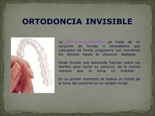 ORTODONCIA INVISIBLE

      La ortodoncia invisible se trata de un
      conjunto de férulas o alineadores que
      colocados de forma progresiva van moviendo
      los dientes hasta la situación deseada.

      Estas férulas van aplicando fuerzas sobre los
      dientes para variar su posición, de la misma
      manera     que   lo   haría  un   bracket.

      En un primer momento se realiza un molde de
      la boca del paciente en su estado inicial.
 