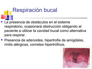 Respiración bucal
 La presencia de obstáculos en el sistema
respiratorio, ocasionará obstrucción obligando al
paciente a utilizar la cavidad bucal como alternativa
para respirar.
 Presencia de adenoides, hipertrofia de amígdalas,
rinitis alérgicas, cornetes hipertróficos.
 