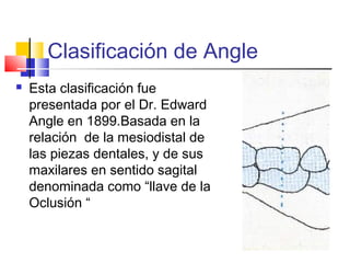 Clasificación de Angle
 Esta clasificación fue
presentada por el Dr. Edward
Angle en 1899.Basada en la
relación de la mesiodistal de
las piezas dentales, y de sus
maxilares en sentido sagital
denominada como “llave de la
Oclusión “
 