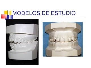 MODELOS DE ESTUDIO
 