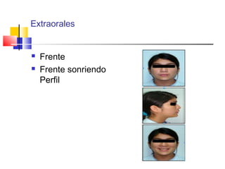Extraorales
 Frente
 Frente sonriendo
Perfil
 
