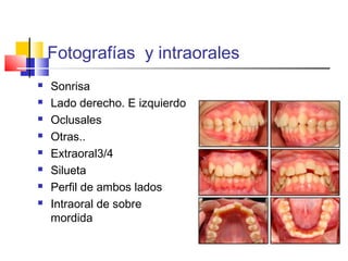 Fotografías y intraorales
 Sonrisa
 Lado derecho. E izquierdo
 Oclusales
 Otras..
 Extraoral3/4
 Silueta
 Perfil de ambos lados
 Intraoral de sobre
mordida
 