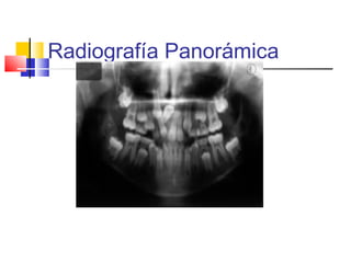 Radiografía Panorámica
 