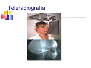 Teleradiografía
 