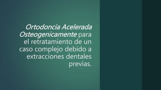 Ortodoncia Acelerada
Osteogenicamente para
el retratamiento de un
caso complejo debido a
extracciones dentales
previas.
 