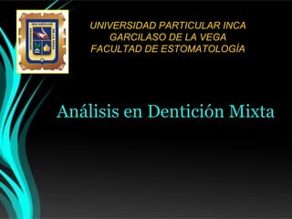UNIVERSIDAD PARTICULAR INCA
GARCILASO DE LA VEGA
FACULTAD DE ESTOMATOLOGÍA

Análisis en Dentición Mixta

 