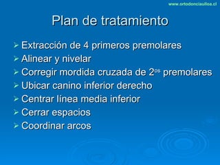 Plan de tratamiento Extracción de 4 primeros premolares Alinear y nivelar Corregir mordida cruzada de 2 os  premolares Ubicar canino inferior derecho Centrar línea media inferior Cerrar espacios Coordinar arcos 