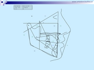 www.ortodonciaulloa.cl   