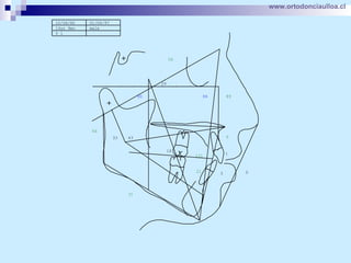 www.ortodonciaulloa.cl   