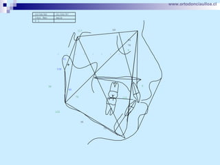 www.ortodonciaulloa.cl   