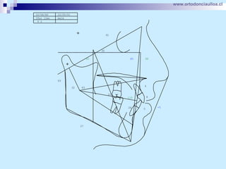 www.ortodonciaulloa.cl   