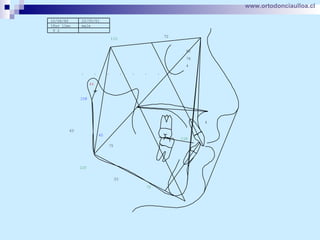 www.ortodonciaulloa.cl   