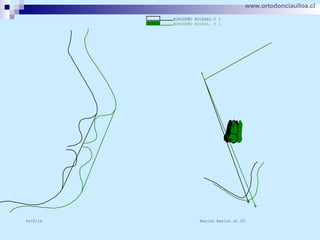 www.ortodonciaulloa.cl   
