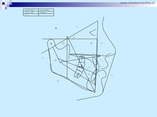 www.ortodonciaulloa.cl   